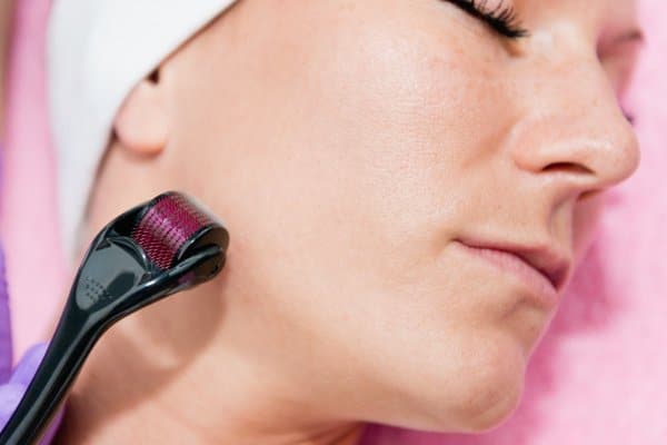 better outcomes with topical PRP and microneedling